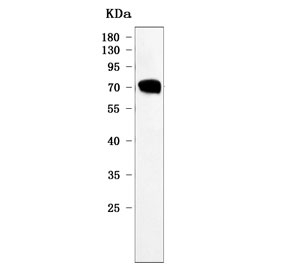 CHGA Antibody WB. Western blot testing of human SH-SY5Y cell lysate with CHGA antibody. Predicted molecular weight ~50 kDa but may be observed at higher molecular weights due to glycosylation.