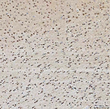 IHC staining of FFPE rat brain tissue with U2 snRNP A antibody. HIER: boil tissue sections in pH8 EDTA for 20 min and allow to cool before testing.