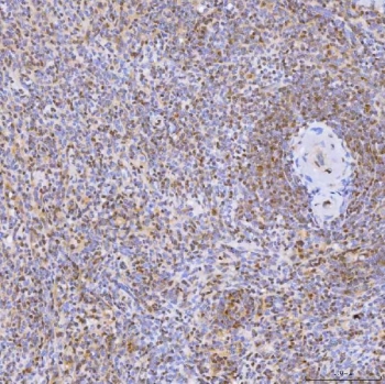 IHC staining of FFPE human spleen tissue with U1 snRNP C antibody. HIER: boil tissue sections in pH8 EDTA for 20 min and allow to cool before testing.