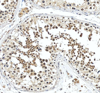 IHC staining of FFPE human testis tissue with Snurportin 1 antibody, HRP-secondary and DAB substrate. HIER: boil tissue sections in pH8 EDTA for 20 min and allow to cool before testing.