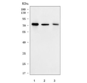 SNX9 Antibody Human Cell and Tissue WB. Western blot testing of human K562, 293T and placenta tissue lysates with SNX9 Antibody. Lane 1: K562 lysate; Lane 2: 293T lysate; Lane 3: human placenta tissue lysate. Predicted molecular weight: ~67 kDa, with SNX9 commonly observed between 67â78 kDa due to post-translational modification and gel migration differences. SNX9 Antibody, an endocytic trafficking protein marker, detects a major band consistent with Sorting Nexin 9 expression and supports studies of vesicle transport, membrane remodeling and intracellular trafficking pathways.