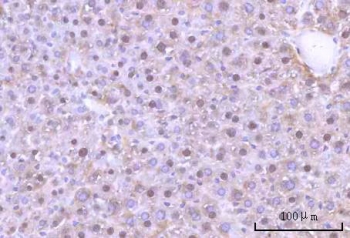IHC staining of FFPE human mouse liver tissue with Nesprin 3 antibody. HIER: boil tissue sections in pH8 EDTA for 20 min and allow to cool before testing.