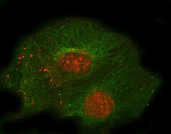 Thrombomodulin Antibody for IF / Endothelial Cell Immunofluorescence Marker. Immunofluorescence analysis of Thrombomodulin / THBD expression in human A431 cells using Thrombomodulin Antibody for IF. FFPE cells show red fluorescence highlighting thrombomodulin-associated membrane localization, while Alpha Tubulin antibody (green) labels the cytoskeletal microtubule network. Antigen retrieval was performed by steaming sections in pH 6 citrate buffer for 20 minutes.