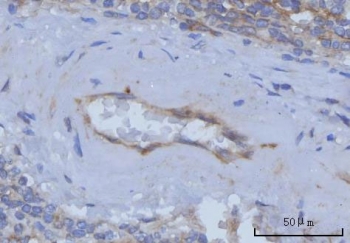IHC staining of FFPE human spleen tissue with Thrombomodulin antibody. HIER: boil tissue sections in pH8 EDTA for 20 min and allow to cool before testing.