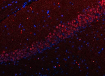 Immunofluorescent staining of FFPE rat brain tissue with Regulatory factor X 3 antibody (red) and DAPI nuclear stain (blue). HIER: steam section in pH8 EDTA buffer for 20 min.