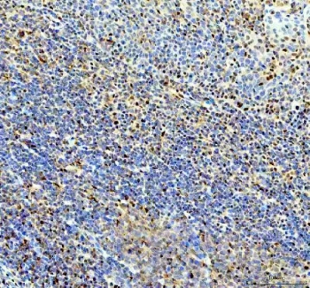 IHC staining of FFPE human tonsil tissue with P15RS antibody. HIER: boil tissue sections in pH8 EDTA for 20 min and allow to cool before testing.