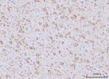 IHC staining of FFPE rat brain tissue with RAP1GAP antibody. HIER: boil tissue sections in pH8 EDTA for 20 min and allow to cool before testing.