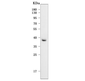 Western blot testing of human HCCT cell lysate with Paraoxonase 2 antibody. Predicted molecular weight: ~39/39/38 kDa (isoforms 1/2/3). 