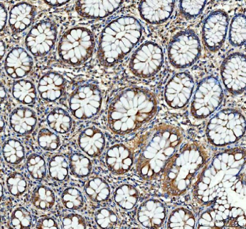 Immunohistochemical staining of FFPE human colon tissue with SGSH antibody, HRP-secondary and DAB substrate. HIER: boil tissue sections in pH8 EDTA for 20 min and allow to cool before testing.
