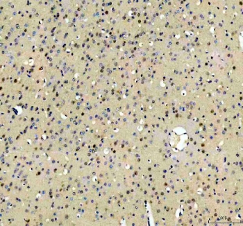 IHC staining of FFPE mouse brain tissue with RBM25 antibody. HIER: boil tissue sections in pH8 EDTA for 20 min and allow to cool before testing.