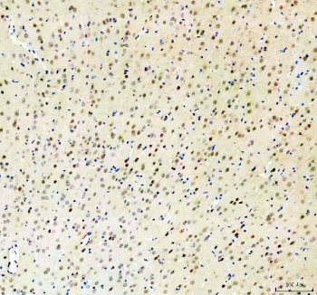 IHC staining of FFPE rat brain tissue with RBM25 antibody. HIER: boil tissue sections in pH8 EDTA for 20 min and allow to cool before testing.