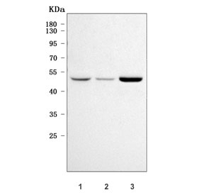 Western blot testing of human 1) HeLa, 2) HepG2 and 3) MCF7 cell lysate with Sphingosine kinase 1 antibody. Predicted molecular weight: ~43/51/44 kDa (isoforms 1/2/3).