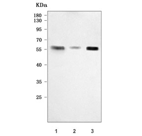 Western blot testing of human 1) HaCaT, 2) Caco-2 and 3) K562 cell lysate with PTPIP51 antibody. Predicted molecular weight ~52 kDa.