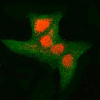 Immunofluorescence analysis of RNF34 and Tubulin beta in human A549 cells. RNF34 antibody (red) staining shows predominant nuclear localization with punctate signal distributed within the nucleus, accompanied by weaker punctate staining in the cytoplasm. Tubulin beta antibody (green) highlights the cytoplasmic microtubule network, providing contrast to the nuclear RNF34 signal. Cells were fixed and blocked prior to incubation with rabbit anti-RNF34 antibody and mouse anti-Tubulin beta antibody, followed by Cy3-conjugated goat anti-rabbit IgG (red) and DyLight 488-conjugated goat anti-mouse IgG (green). Images were acquired using a fluorescence microscope with appropriate filter sets.
