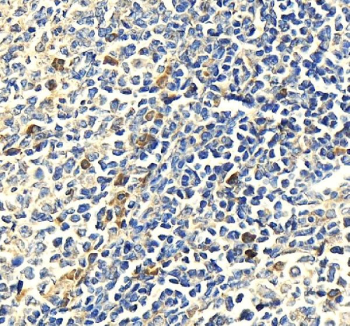 IHC staining of FFPE human tonsil tissue with Myeloperoxidase antibody, HRP-secondary and DAB substrate. HIER: boil tissue sections in pH8 EDTA for 20 min and allow to cool before testing.