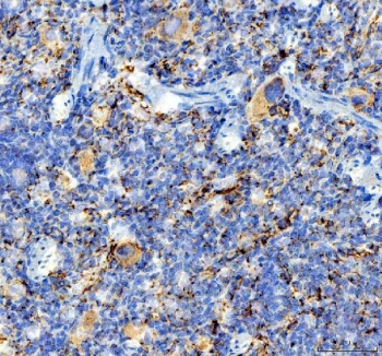 IHC staining of FFPE rat spleen tissue with ITGA2B antibody. HIER: boil tissue sections in pH8 EDTA for 20 min and allow to cool before testing.
