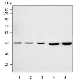 Western blot testing of 1) human 293T, 2) human Jurkat, 3) human SH-SY5Y, 4) rat brain and 5) mouse brain tissue lysate with Tropomodulin 2 antibody. Predicted molecular weight ~40 kDa.