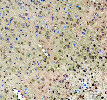 Immunohistochemistry analysis of ROCK1 expression in mouse brain tissue. Paraffin-embedded mouse brain tissue sections were subjected to heat-mediated antigen retrieval in EDTA buffer (pH 8.0) and incubated with anti-ROCK1 antibody, followed by HRP-conjugated secondary antibody and DAB chromogen development. ROCK1 immunoreactivity is detected in neural cells and surrounding neuropil, with hematoxylin nuclear counterstain (blue).