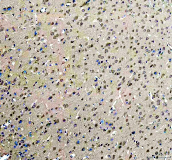 Immunohistochemistry analysis of ROCK1 expression in rat brain tissue. Paraffin-embedded rat brain tissue sections were subjected to heat-mediated antigen retrieval in EDTA buffer (pH 8.0) and incubated with anti-ROCK1 antibody, followed by HRP-conjugated secondary antibody and DAB chromogen development. Brown staining is observed in neuronal cells, consistent with cytoplasmic ROCK1 localization, with hematoxylin nuclear counterstain (blue).