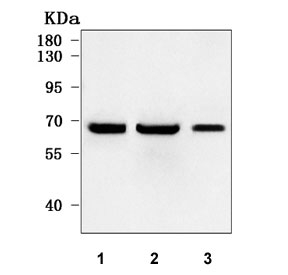 Western blot testing of human 1) ThP-1, 2) HepG2 and 3) T-47D cell lysate with Ribophorin II antibody. Predicted molecular weight ~69 kDa.