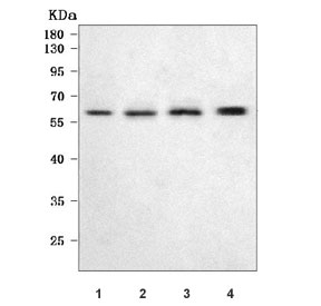 Western blot analysis of OCLN antibody in rat and mouse tissue lysates. Lanes: 1) rat liver, 2) rat RH35 cells, 3) mouse liver, and 4) mouse kidney. The rabbit polyclonal antibody detects a clear band at approximately 59 kDa across all samples, consistent with the predicted molecular weight of Occludin. Band intensity is comparable between rat and mouse tissues, supporting cross-reactivity in rodent models and confirming detection of endogenous Ocln protein in liver and kidney lysates.