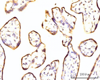 IHC staining of FFPE placental tissue with RPL11 antibody. HIER: boil tissue sections in pH8 EDTA for 20 min and allow to cool before testing.