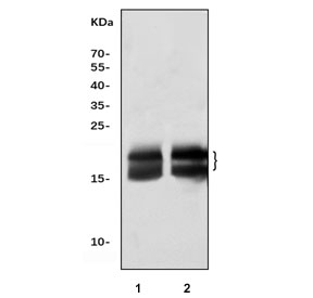 CRYAA Antibody Rat and Mouse Eye WB. Western blot analysis of CRYAA expression was performed using anti-CRYAA antibody. Lane 1: rat eye tissue lysate. Lane 2: mouse eye tissue lysate. CRYAA (Alpha A Crystallin) is a small heat shock protein and ATP-independent molecular chaperone that maintains lens transparency by preventing protein aggregation and protecting cells from oxidative stress. Specific immunoreactive bands are detected at approximately 20-23 kDa, consistent with the expected molecular weight of CRYAA. These results demonstrate cross-species reactivity and support the utility of CRYAA Antibody for studies of lens biology, molecular chaperone function, protein homeostasis, cataract mechanisms, and ocular disease.