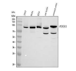 PDXDC1 Antibody Human, Mouse and Rat WB. Western blot testing of human 293T, human HeLa, human RT4, rat testis and mouse testis lysates with PDXDC1 Antibody at 0.5 ug/ml. Lane 1: human 293T; Lane 2: human HeLa; Lane 3: human RT4; Lane 4: rat testis; Lane 5: mouse testis. A specific band was detected at approximately 87 kDa, consistent with the predicted molecular weight of the full-length PDXDC1 protein. PDXDC1 Antibody / Pyridoxal Decarboxylase Domain Protein Antibody supports studies of pyridoxal-dependent enzyme domain proteins, metabolic regulation and conserved cellular pathways.