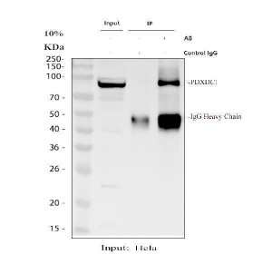 PDXDC1 Antibody HeLa Cell IP. Immunoprecipitation of PDXDC1 from human HeLa whole cell lysate using PDXDC1 Antibody. Lane 1: HeLa input lysate; Lane 2: rabbit control IgG immunoprecipitation; Lane 3: PDXDC1 antibody immunoprecipitation. The immunoprecipitated protein was detected by Western blot using PDXDC1 antibody at 0.5 ug/ml, with a specific band observed at approximately 87 kDa, consistent with the predicted molecular weight of PDXDC1. PDXDC1 Antibody / Pyridoxal Decarboxylase Domain Protein Antibody supports protein interaction studies and analysis of pyridoxal-dependent enzyme domain protein expression.