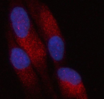 Immunofluorescent staining of FFPE human HeLa cells with PATL2 antibody (green) and DAPI nuclear stain (blue). HIER: steam section in pH6 citrate buffer for 20 min.