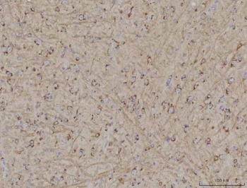 TMEM87A Antibody Mouse Brain IHC. Immunohistochemical staining of FFPE mouse brain tissue using TMEM87A Antibody / Transmembrane Protein 87A Antibody. Heat-induced epitope retrieval was performed using pH8 EDTA buffer, followed by HRP-conjugated secondary antibody detection and DAB chromogen. Diffuse cytoplasmic and membranous staining is observed throughout the brain parenchyma, consistent with TMEM87A expression in neural tissue. This TMEM87A Antibody, also called Transmembrane Protein 87A Antibody, is suitable for studies of membrane protein expression, intracellular trafficking, neurobiology, and cellular signaling.