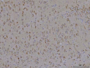 TMEM87A Antibody Rat Brain IHC. Immunohistochemical staining of FFPE rat brain tissue using TMEM87A Antibody / Transmembrane Protein 87A Antibody. Heat-induced epitope retrieval was performed using pH8 EDTA buffer, followed by HRP-conjugated secondary antibody detection and DAB chromogen. Moderate cytoplasmic and membranous staining is observed throughout the brain parenchyma, consistent with TMEM87A expression in neural tissue. This TMEM87A Antibody, also called Transmembrane Protein 87A Antibody, is suitable for studies of membrane protein expression, intracellular trafficking, neurobiology, and cellular signaling.