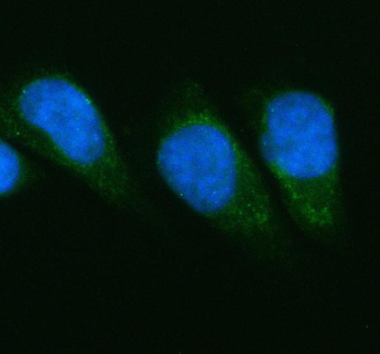 Immunofluorescent staining of FFPE human HeLa cells with PGAM1 antibody (green) and DAPI nuclear stain (blue). HIER: steam section in pH6 citrate buffer for 20 min.