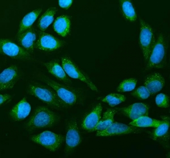 Immunofluorescent staining of FFPE human U-2 OS cells with 40S ribosomal protein S14 antibody (green) and DAPI nuclear stain (blue). HIER: steam section in pH6 citrate buffer for 20 min.