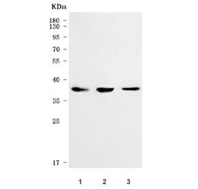 Western blot testing of human 1) T-47D, 2) RT4 and 3) MOLT4 cell lysate with SVOPL antibody. Predicted molecular weight ~37 kDa and ~54 kDa (two isoforms).