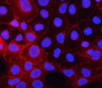 PDGFR Alpha Antibody IF. Immunofluorescent staining of FFPE human Caco-2 cells using PDGFR Alpha Antibody / Receptor Tyrosine Kinase Antibody demonstrates prominent membranous and cytoplasmic red fluorescence consistent with expression of PDGFRA. The staining pattern highlights cell borders and associated intracellular compartments, reflecting the localization of this cell-surface receptor tyrosine kinase. PDGFRA mediates platelet-derived growth factor signaling and regulates cellular proliferation, migration, differentiation, and survival through activation of downstream signaling pathways. Nuclei are counterstained with DAPI (blue). HIER was performed by steaming sections in pH 6 citrate buffer for 20 minutes prior to immunofluorescent staining. Red = PDGFR Alpha antibody; Blue = DAPI nuclear stain.