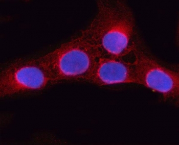 ORP9 Antibody IF. Immunofluorescent staining of FFPE human U-2 OS cells with ORP9 antibody (red) and DAPI nuclear stain (blue). HIER: steam section in pH6 citrate buffer for 20 min.