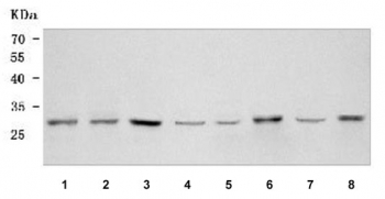 Western blot testing of 1) human HeLa, 2) human HepG2, 3) human MCF7, 4) human placenta, 5) rat liver, 6) rat PC-12, 7) mouse liver and 8) mouse C2C12 cell lysate with OSTF1 antibody. Predicted molecular weight ~24 kDa, commonly observed at 24-28 kDa.