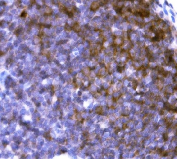 Rat CD19 Antibody IHC. Immunohistochemistry staining of FFPE rat lymph node tissue with Cd19 antibody. HIER: boil tissue sections in pH8 EDTA for 20 min and allow to cool before testing.