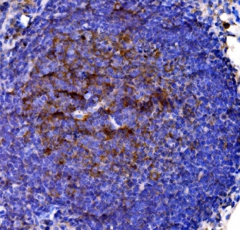 CD38 Antibody rat lymph node tissue IHC. Immunohistochemistry analysis of Cd38 / plasma cell marker expression in FFPE rat lymph node tissue using a CD38 antibody. Strong membranous and cytoplasmic HRP-DAB brown staining highlights lymphocyte populations within cortical and paracortical regions, with dense signal in immune cell-rich compartments. The staining pattern demonstrates conserved Cd38 expression in rodent lymphoid tissue with clear contrast against surrounding negative stromal elements. HIER was performed by boiling tissue sections in pH 8 EDTA buffer for 20 minutes followed by cooling prior to antibody incubation.