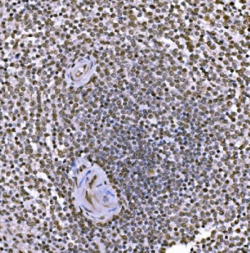 JUN Antibody Human Spleen IHC. Immunohistochemical staining of FFPE human spleen tissue using JUN Antibody demonstrates widespread nuclear HRP-DAB brown staining throughout splenic cellular populations, with particularly prominent staining surrounding lymphoid follicles. The staining pattern is consistent with expression of JUN (c-Jun), a DNA-binding component of the AP-1 transcription factor complex that regulates gene expression involved in immune responses, cellular activation, differentiation, and stress-responsive signaling pathways. The predominantly nuclear localization is characteristic of a transcription factor and supports the role of JUN in coordinating transcriptional programs within immune-associated tissues. HIER: boil tissue sections in pH 8 EDTA buffer for 20 minutes and allow to cool before testing.