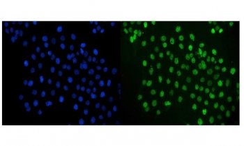 JUN Antibody A431 Cell IF. Immunofluorescent staining of FFPE human A431 cells using JUN Antibody demonstrates strong green nuclear staining throughout the cell population, consistent with localization of JUN (c-Jun), a DNA-binding component of the AP-1 transcription factor complex. JUN functions as a key regulator of gene expression involved in cellular proliferation, differentiation, stress responses, and signal-dependent transcriptional regulation. The highly restricted nuclear staining pattern is characteristic of a transcription factor and supports the role of JUN in controlling transcriptional programs that govern cellular adaptation and signaling responses. DAPI (blue) counterstains cell nuclei. HIER: steam tissue sections in pH 6 citrate buffer for 20 minutes prior to staining.