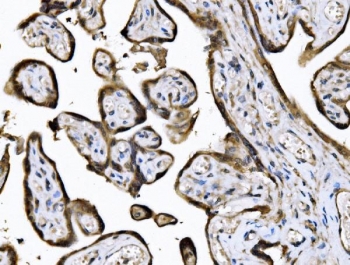 IHC staining of FFPE human placental tissue with KIF2A antibody. HIER: boil tissue sections in pH8 EDTA for 20 min and allow to cool before testing.