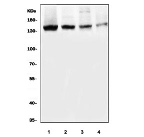 Western blot testing of human 1) SK-O-V3, 2) HEL, 3) K562 and 4) Caco-2 cell lysate with PRDM3 antibody. Predicted molecular weight ~138 kDa.