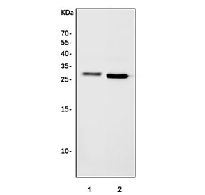 Western blot testing of 1) rat liver and 2) mouse liver tissue lysate with Nr0b2 antibody. Predicted molecular weight ~28 kDa.