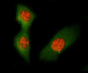 Asc Antibody Mouse RM-1 Cell IF. Immunofluorescent staining of FFPE mouse RM-1 cells using Asc Antibody (red) and Alpha Tubulin monoclonal antibody (green). Asc is detected predominantly within the cytoplasm, consistent with its role as an inflammasome adaptor protein that mediates innate immune signaling, ASC speck formation, and inflammatory caspase activation. Alpha Tubulin staining highlights the microtubule cytoskeleton. Heat-induced epitope retrieval was performed by steaming sections in pH 6 citrate buffer for 20 minutes prior to immunofluorescent staining.