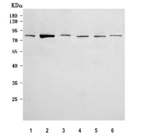 Western blot testing of 1) human A431, 2) human 293T, 3) human Caco-2, 4) human PC-3, 5) rat brain and 6) mouse brain tissue lysate with Delta-like protein 4 antibody. Predicted molecular weight ~75 kDa but may be observed at higher molecular weights due to glycosylation.