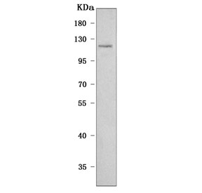 Western blot testing of human SH-SY5Y cell lysate with PLEKHG5 antibody. Predicted molecular weight ~122 kDa.