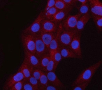 PNPLA6 Antibody for IF. Immunofluorescence analysis in human U-2 OS cells. FFPE human U-2 OS cells stained with PNPLA6 antibody (red) show predominantly cytoplasmic staining, consistent with its role as a membrane-associated phospholipase. Nuclei are counterstained with DAPI (blue). Antigen retrieval was performed using pH6 citrate buffer with heat-induced epitope retrieval prior to staining.