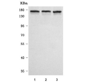 PNPLA6 Antibody for WB. Western blot analysis in human HeLa, 293T, and SH-SY5Y cell lysates. Lane 1: HeLa lysate, Lane 2: 293T lysate, Lane 3: SH-SY5Y lysate. A band is detected at approximately 140-150 kDa, consistent with the predicted molecular weight of Patatin-like phospholipase domain-containing protein 6 / PNPLA6. The observed band pattern likely reflects multiple isoforms of PNPLA6, which are known to arise from alternative splicing and contribute to its diverse roles in phospholipid metabolism and neuronal maintenance.